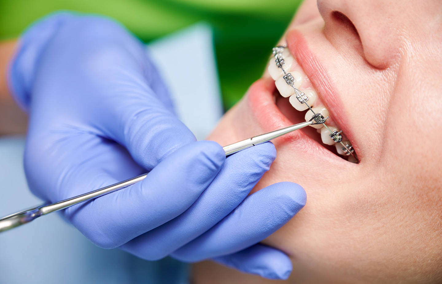 15 Fun Facts About Orthodontics You Might Not Know