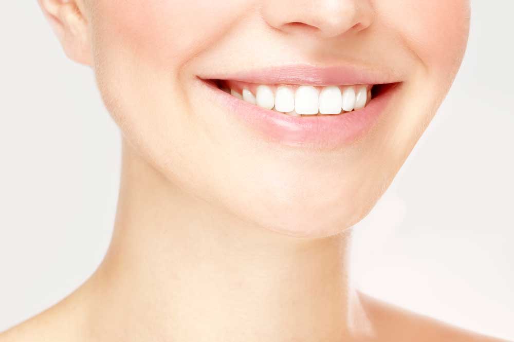 Enhance Your Smile with Veneers: A Simple Path to a Radiant Look