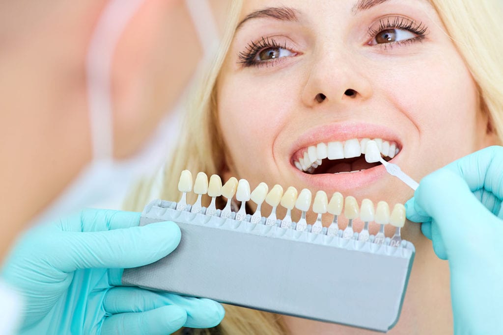 Exploring Cosmetic Dentistry: Veneers, Crowns, and More